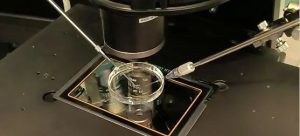 图片[2]-伊朗试管辅助代孕分七步 - 辅助生殖论坛-辅助生殖论坛