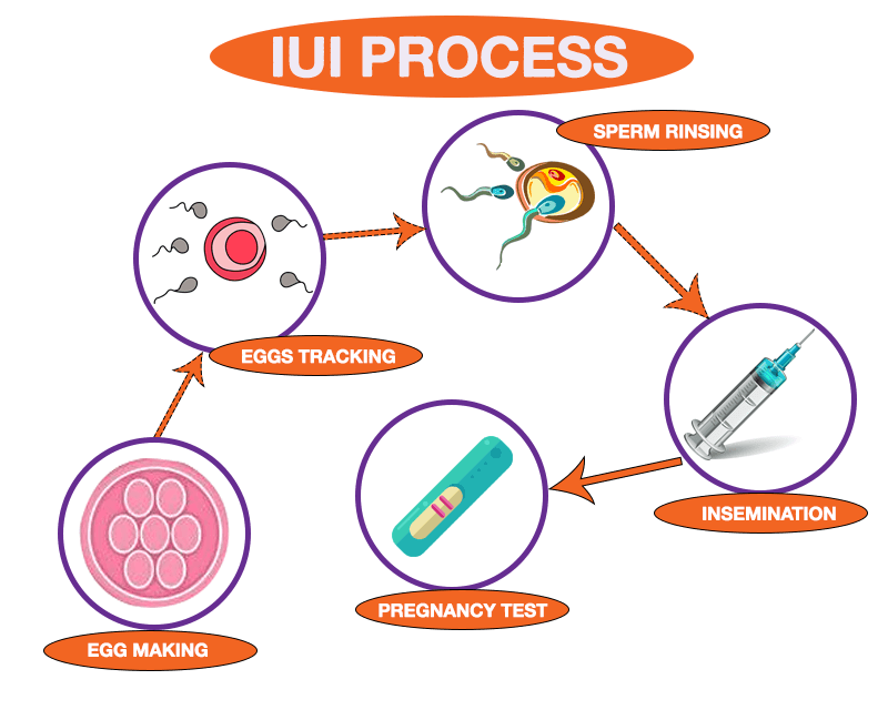 菲律宾 IUI 成本、程序、成功率 - 辅助生殖论坛-辅助生殖论坛