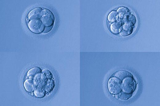 4AA 胚胎和 IVF 过程 - 辅助生殖论坛-辅助生殖论坛