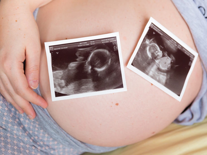 Surrogacy in Portugal: cost and legality | VittoriaVita