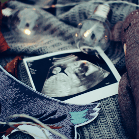 超声波宝丽来照片