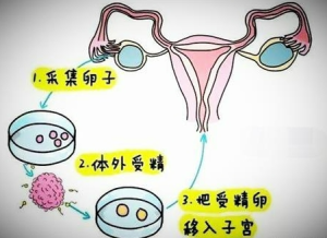 辅助生殖代孕技术成功率有多少？ - 辅助生殖论坛-辅助生殖论坛