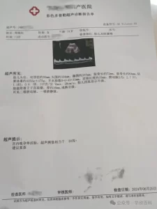 38岁未婚女性的母爱抉择：代孕之旅 - 辅助生殖论坛-辅助生殖论坛