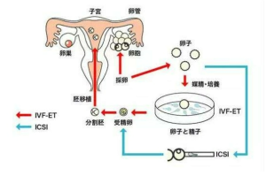 俄罗斯NGC生殖专家：子宫内膜厚度多少才适合移植胚胎呢？ - 辅助生殖论坛-辅助生殖论坛