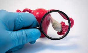 如果您患有多囊卵巢综合症，您可以捐献卵子吗？-辅助生殖论坛