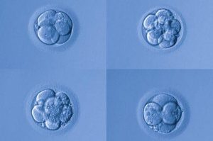 4AA 胚胎和 IVF 过程-辅助生殖论坛