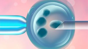 肯尼亚的卵子捐赠-辅助生殖论坛