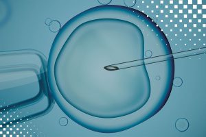 体外受精(IVF)——这个过程需要多长时间以及何时可以考虑它作为一种选择?-辅助生殖论坛