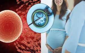 IVF 与 ICSI – 更好的选择-辅助生殖论坛