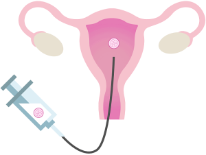 试管婴儿和代孕有什么区别-辅助生殖论坛